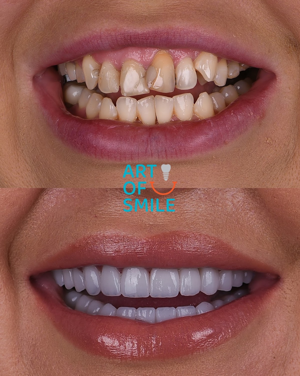 Opšta stomatologija - ART OF SMILE DSD - Stomatolog Novi Sad