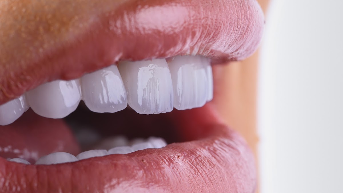 Ortodoncija - ART OF SMILE DSD - Stomatolog Novi Sad